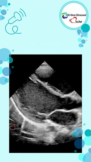 1.2K views · 20 shares | ⏱️ Echo Insight: Mastering Temporal...