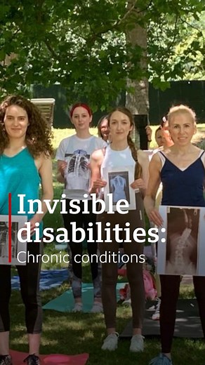 What is living with an invisible disability like in London? Chronic conditions like scoliosis make up around 18% of non-visible disabilities in the UK. Emily had to have spinal surgery for her scoliosis, now she's helping others. | BBC London