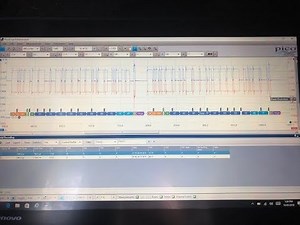 Toyota Fortuner CAN bus signal