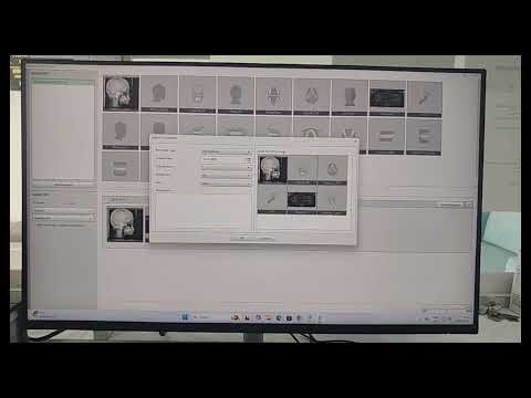Lateral Cephalogram & Lateral Cephalometric Analysis