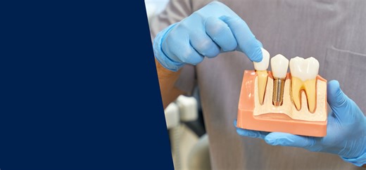 Dental Implants | Prosthodontics | Patients at the Faculty of Dentistry Clinics (University of Toronto)