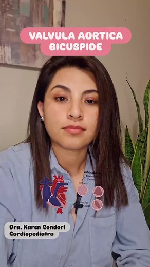 Válvula Aórtica Bicuspide: Cardiopatía Congénita Frecuente