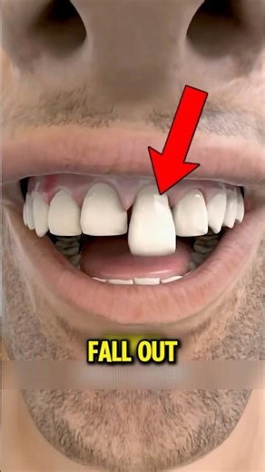 Teeth Don’t Fall Out From Age Here’s the Real Reason 😱