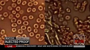 WHAT COVID INJECTIONS DO TO YOUR BLOOD [2021-07-16] - DR. JANE RUBY & STEW PETERS (VIDEO)