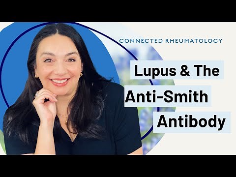 The anti-Smith antibody in Lupus