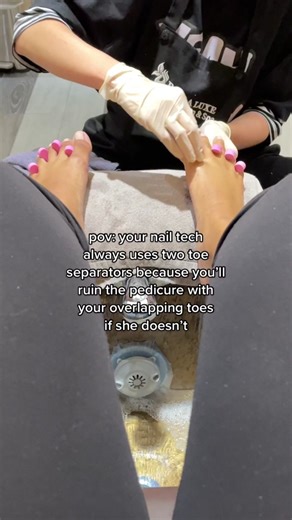 Dealing with Overlapping Toes: Nail Care Tips