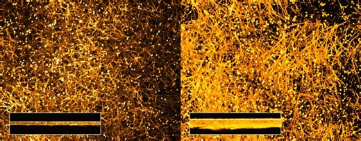 How a Human Protein Helps Turn a Fungus Into a Pathogen | Microbiology