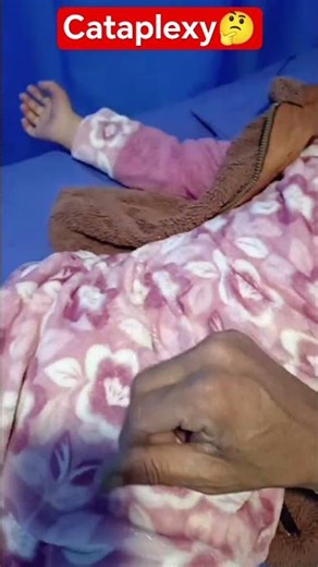 CATAPLEXY#Cataplexy #NarcolepsyType1 #SleepMedicine #NeurologyNotes#MedicalStudents