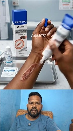 SCRILLS Scar Removal Cream & Silicone Gel | Advanced Scar Treatment for, Keloids & Stretch Marks