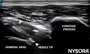 6.6K views · 47 reactions | Case study highlight: The SHAC technique...