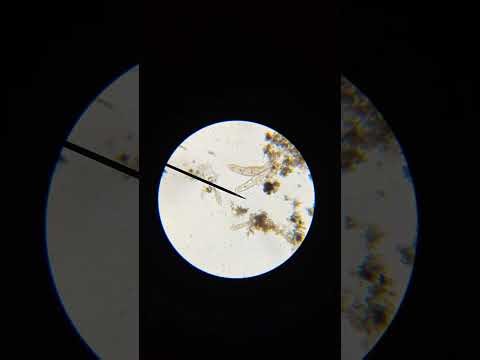 The lives of Rotifers sp. And Paramecium sp. 