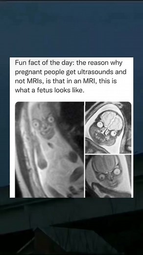 Oddly Terrifying MRI Footage of a Fetus