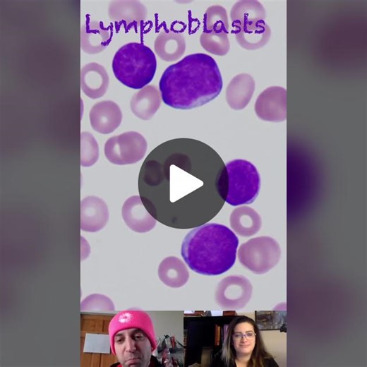 Lymphoblast Morphological Characteristics #medlab #hematology #microscope