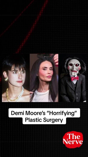 Demi Moore’s botched plastic surgery has a “horrifying” result. #thenerveshow #news #popculture