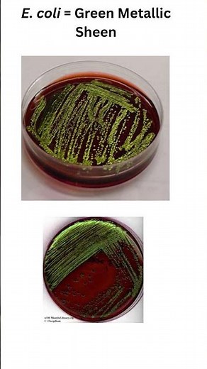 EMB Agar Explained: E. coli Green Sheen & Enterobacter Fish-Eye Colonies