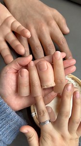 121K views · 131 reactions | Artificial Fingers: The Future of Human Grip Technology #artificialfingers #prosthetics #innovation #futuretech #biotech #robotics #assistivetechnology #humanaugmentation #technews #viraltech | Need To Know | Facebook