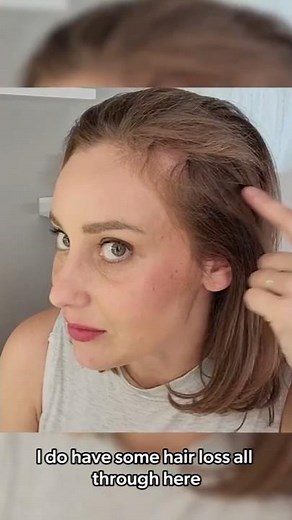 How I Wear My Hair Topper: Simple and Natural Method That Works! | UniWigs Airy Elegance