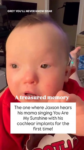Remember this? Shortly after Jaxson received his implants and was “activated” we were just hanging around, I decided to try singing to him to see his reaction. Obviously, it was priceless 😭💛 | jennifer.l.cummings