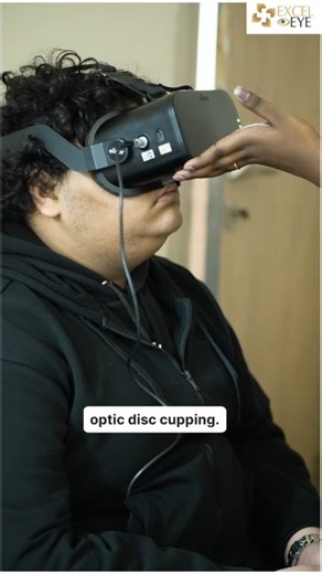 Dr Anisha Seth Gupta on Instagram: "A young boy came in for a routine eye check-up. On examination, we noticed significant optic disc cupping, raising suspicion of glaucoma. We promptly performed visual field testing and OCT, which showed early changes supporting the diagnosis. This case is a reminder that glaucoma can be silent, even in younger patients. Regular eye examinations are essential for early detection and timely intervention. Sometimes, a simple routine check-up can protect vision fo