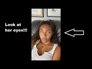 Hypnosis - Spiegel Eye Roll Test As A Deepener