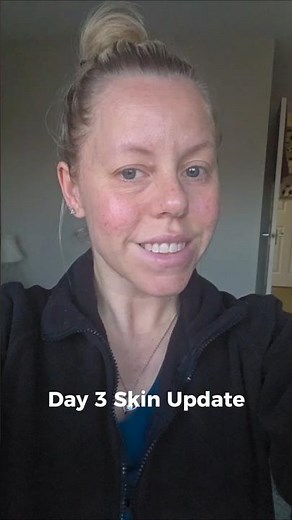 Day 3 fixing my skin redness | CeraVe & The Ordinary routine