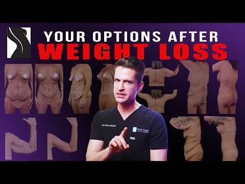 Skin Removal After Weight Loss | Full Body Contouring Guide