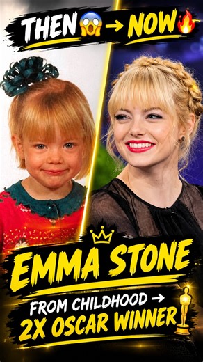 Emma Stone 😱 From Childhood to 2-Time Oscar Winner 🏆 | Then & Now #Shorts