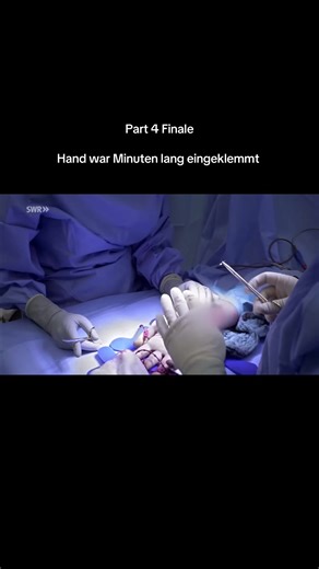 Hand Injury Case Study: Part 4 Finale