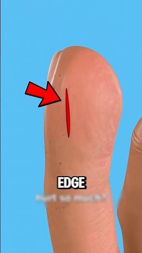 Stop Painful Paper Cuts #FirstAidTips #PaperCutCare #SafeHands