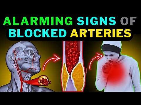 Silent Signs of Artery Blockages You Can’t Ignore
