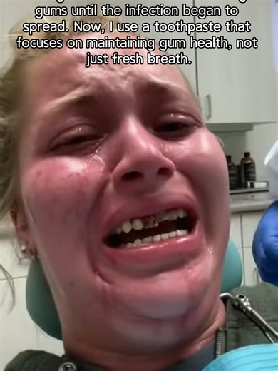 I used to think toothpaste didn’t matter. Cheap was fine. Minty was enough. My gums bled, but I ignored it. Months later, my jaw swelled and the infection spread. That was my wake-up call. Now I use something designed to support my gums — not just make my breath smell good.#toothpaste #smile #teethwhitening #oralcare #oralhealth #dentis #dentalcare #whitesmile #healthyteeth #KUGIG