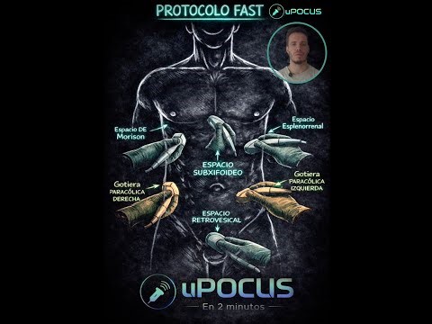 uPOCUS 2 minutos FAST