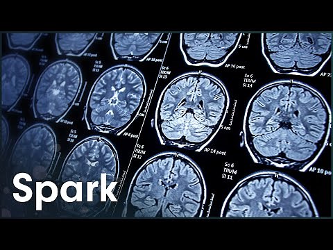 What Happens To The Brain In Old Age?