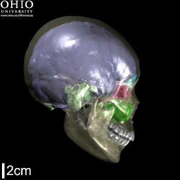Human skull with brain endocast, paranasal sinuses, & mastoid sinuses