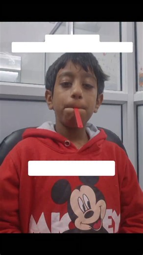 The Shining Star on Instagram: "These exercises help children strengthen the muscles around the lips, which are essential for clear speech, feeding, and oral-motor control"