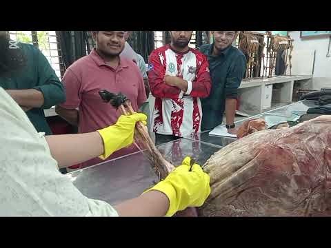 Describtion about Xiphoid Cartilage,Prepubic tendon,Inguinal region and Inguinal Canal .