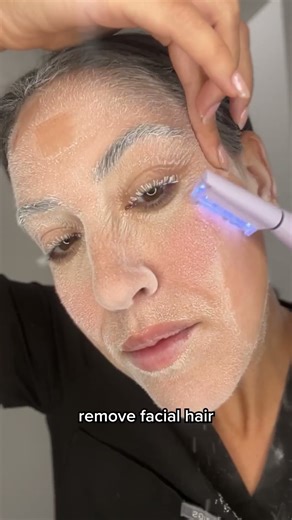 2 in 1 Facial Exfoliation & Peach Fuzz Hair Removal System