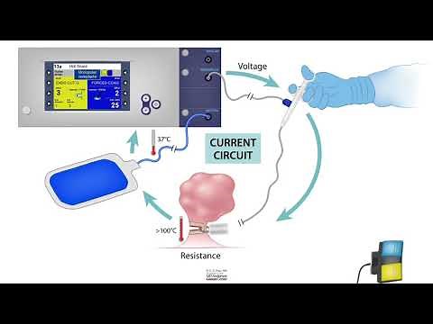 HCC 1472-Lesson-16b-Electrosurgery Monopolar vs Bipolar devices