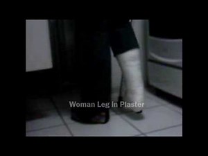 Slwc plaster leg