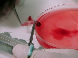 Isolation and Culture of Adult Mouse Cardiomyocytes for Cell Signaling and in vitro Cardiac Hypertrophy