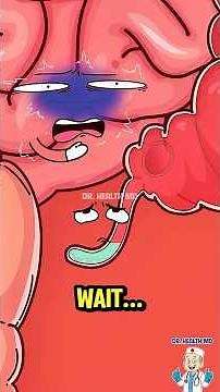 The Truth About Appendicitis: When "Extra" Becomes Deadly! ⚠️#shorts #science