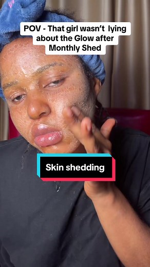 Understanding the Skin Shedding Cycle: A Comprehensive Guide