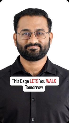 Dr Shaurya Shah on Instagram: "An external fixator is used in severe orthopaedic trauma when fractures are highly unstable, contaminated, or associated with major soft-tissue damage. In high-impact accidents, the bone may be shattered and the surrounding skin may not be healthy enough for internal plates or nails. In such cases, internal fixation can increase the risk of infection and implant failure. An external fixator stabilizes the bone from outside the body, allowing: • Proper alignment of