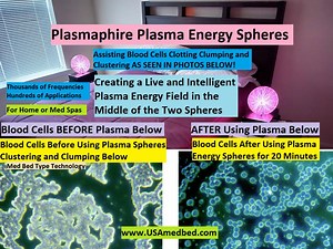 Plasma Energy Spheres Bringing Plasma Energy Based "Med Bed" Technology to Homes in the United States and Canada