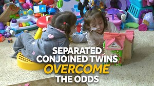 224K views · 20 reactions | Now three, Eva and Erika Sandoval are...