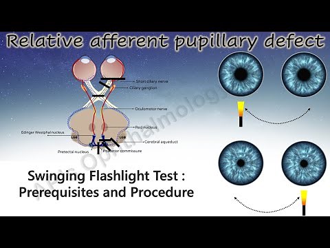 Pupil 3 | How to Perform the Swinging Flashlight Test