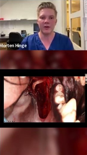 Local block Placement! #vetdentist #anestheticblock #mortenvetdentist