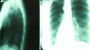 Health Conditions Not Treated by Chiropractors