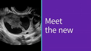 High-performance hardware and flexible software work in harmony with expert-level probes. | GE HealthCare India