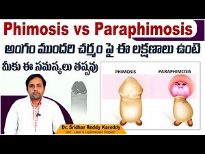Difference Between Phimosis and Paraphimosis || Phimosis vs Paraphimosis || Treatment Range Hospital